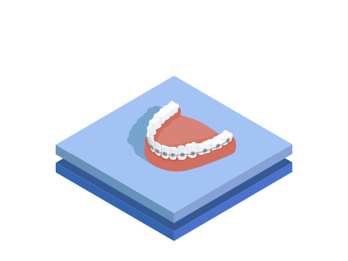 Dermanên Ortodontîk